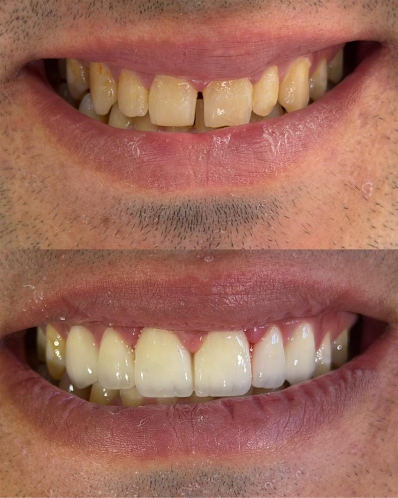 @hndentalklinik Instagram gönderisi 1