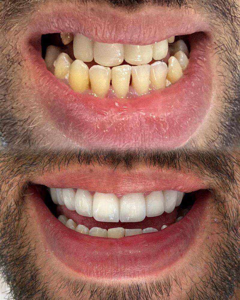 @hndentalklinik Instagram gönderisi 2
